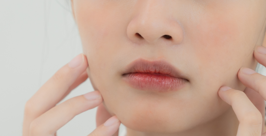 kenali perioral dermatitis