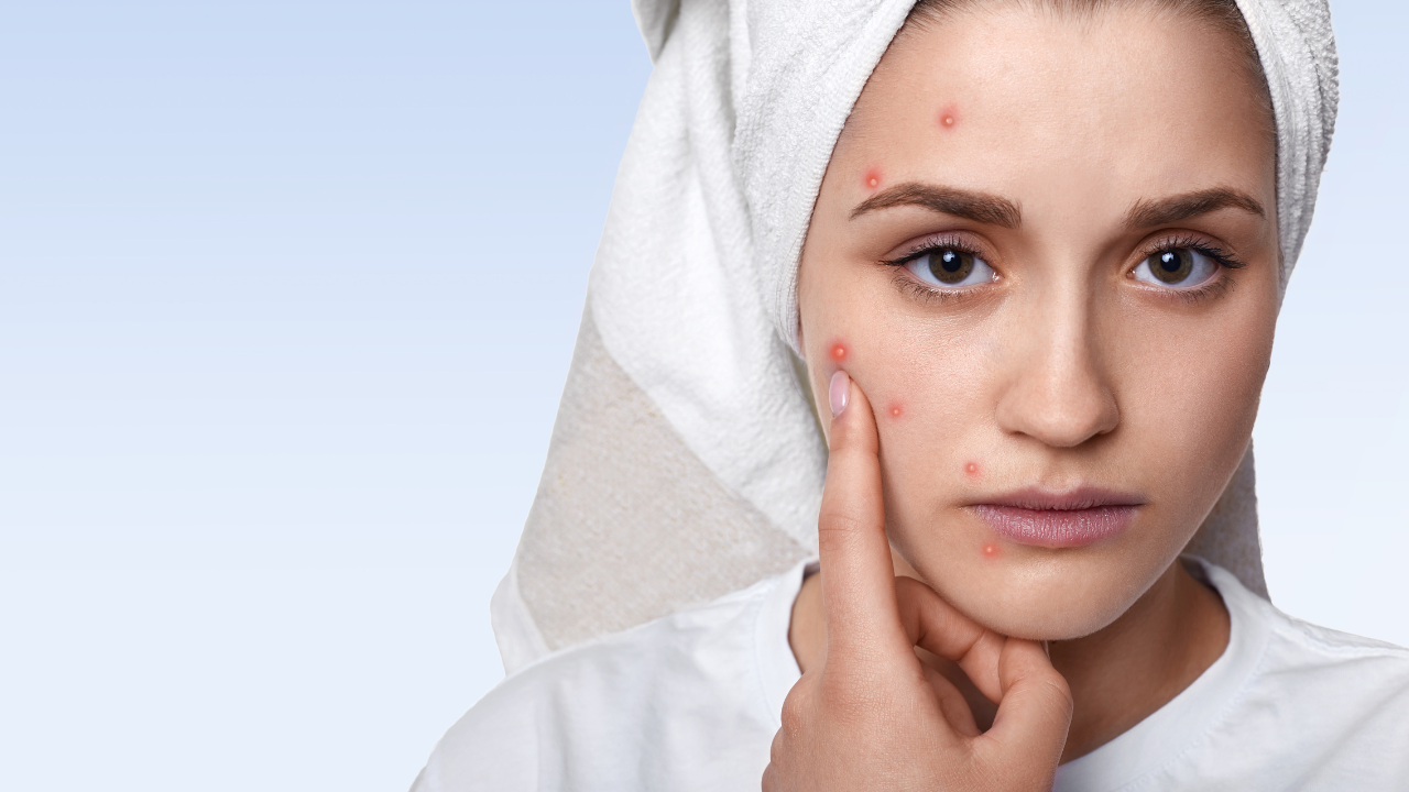 Penyebab kulit bruntusan setelah pakai skincare baru